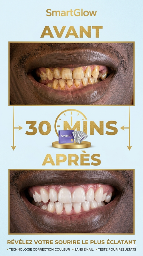 Smilekit - Bandes de Blanchiment Dentaire