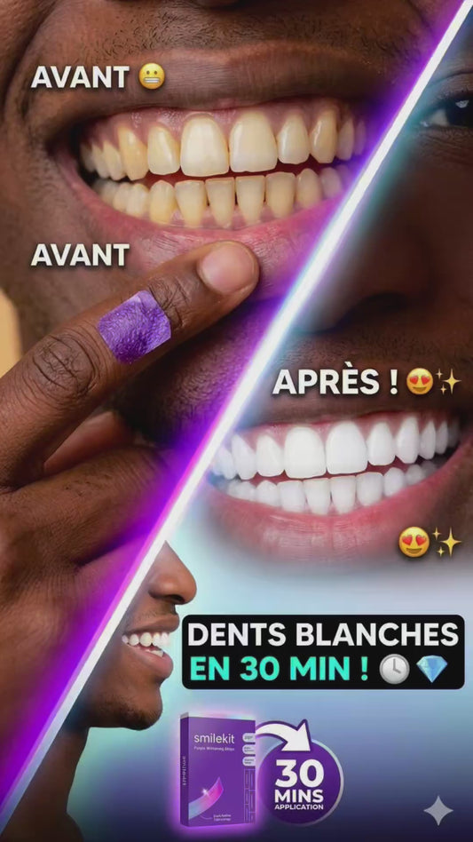 Smilekit - Bandes de Blanchiment Dentaire